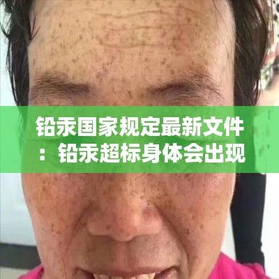 铅汞国家规定最新文件：铅汞超标身体会出现哪些症状 