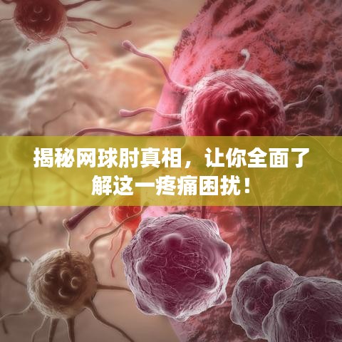 揭秘网球肘真相，让你全面了解这一疼痛困扰！