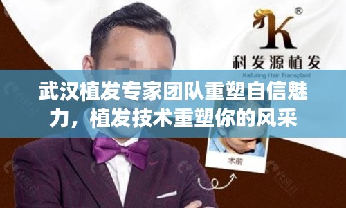 武汉植发专家团队重塑自信魅力，植发技术重塑你的风采