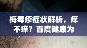 梅毒疹症状解析，痒不痒？百度健康为您解答